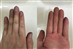 POLAカラートリートメントの手・皮膚・地肌の染まり