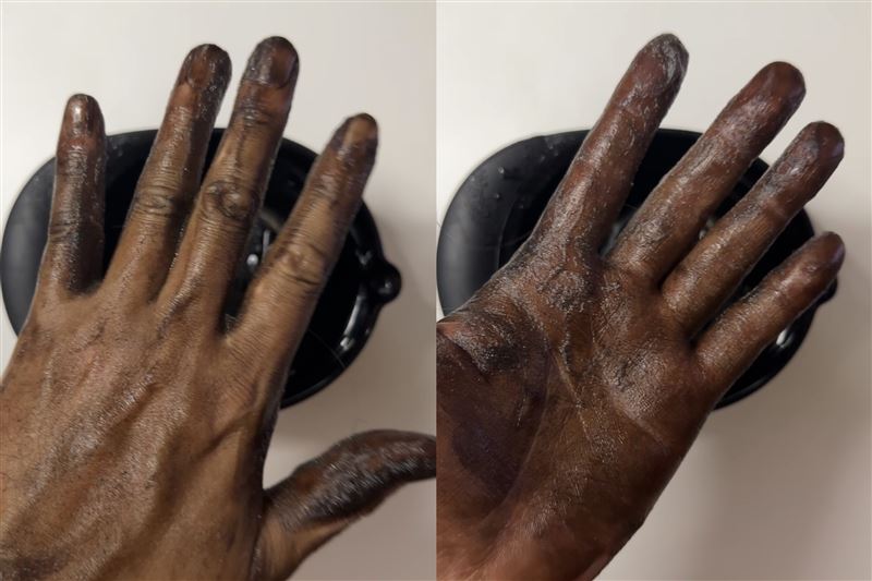 「利尻炭酸カラーシャンプー」体験レビュー素手で染めた手の確認
